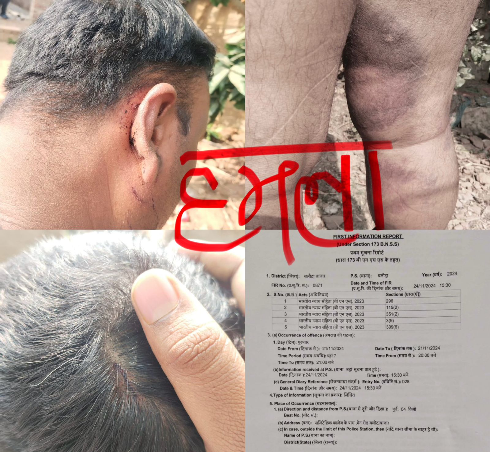 आबकारी अधिकारी के संरक्षण में पल रहे गुण्डों ने पत्रकार पर किया जानलेवा हमला, रुपये भी लुटे, मामला दर्ज…